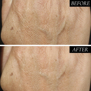 Diamond Contour Intensive Anti-Aging Hand Treatment